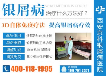 郑州市银屑病牛皮癣医院怎么样呢