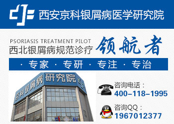 郑州市治疗牛皮癣最好的医院