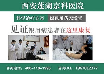 郑州有治疗牛皮癣的医院吗