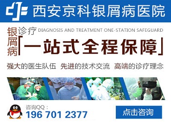 郑州最权威的牛皮癣医院