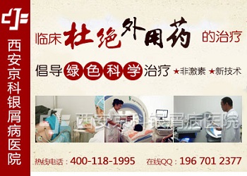 牛皮癣郑州哪个医院最好