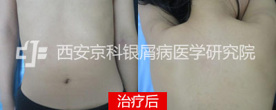 淶 Ȼرƫ;Ů