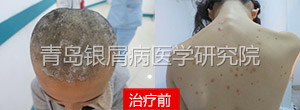 花样琴琴大学染顽疾 遇名医两疗程治愈 花样琴琴大学染顽疾 遇名医两疗程治愈